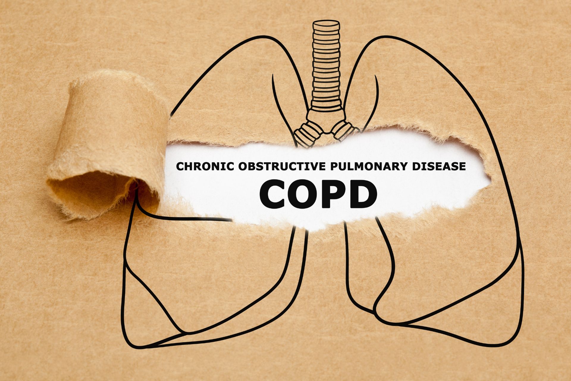 Chronic Obstructive Pulmonary Disease