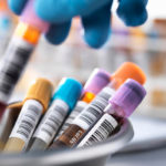 What Is a Clinical Trial? A Beginner-Friendly Guide for NYC Volunteers